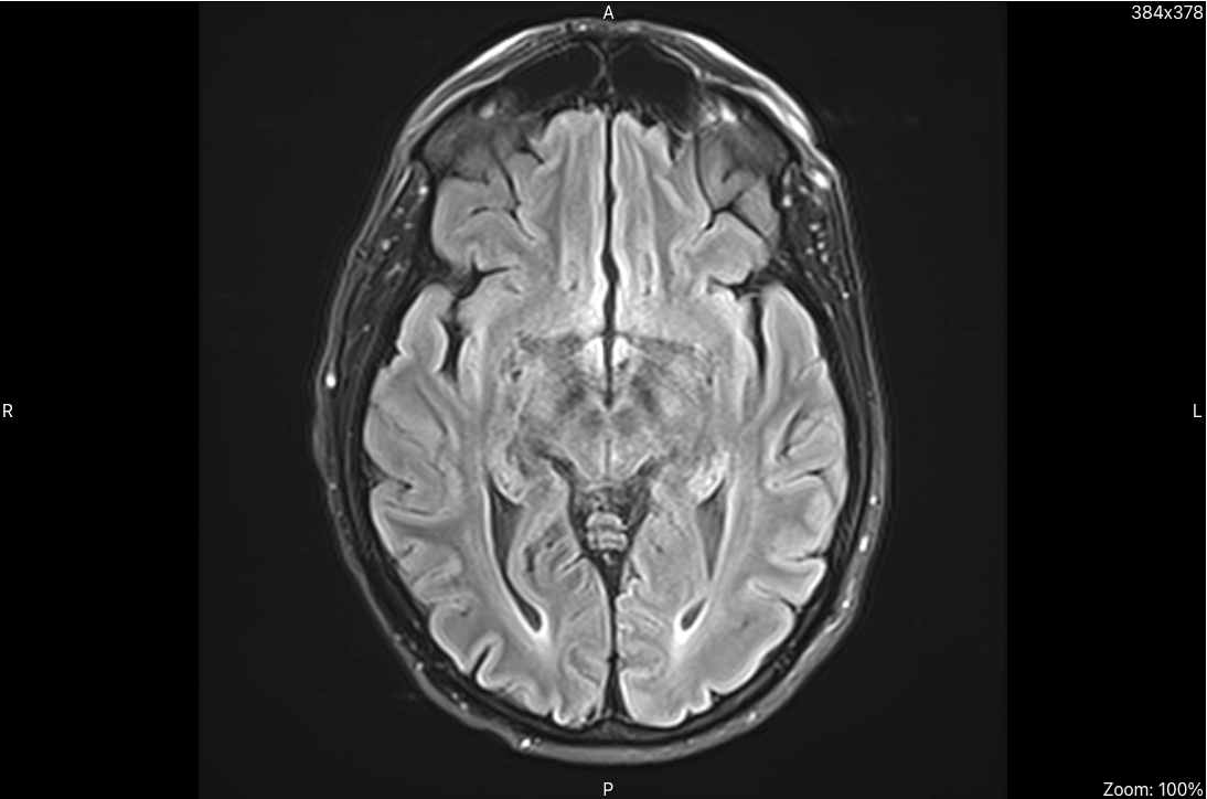 Image of brain in DICOM format